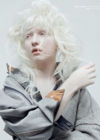 Корейцы альбиносы