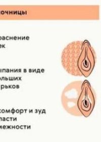 Молочница у женщин на сосках