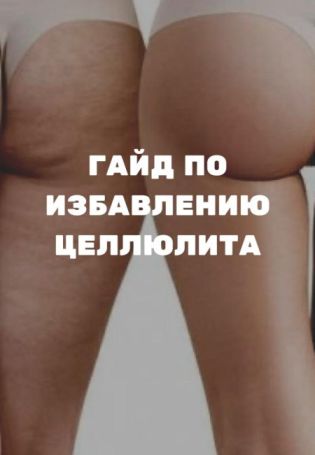 Целлюлит на ногах