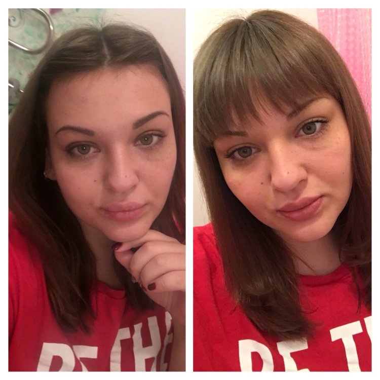 Лоб с залысинами прическа женская