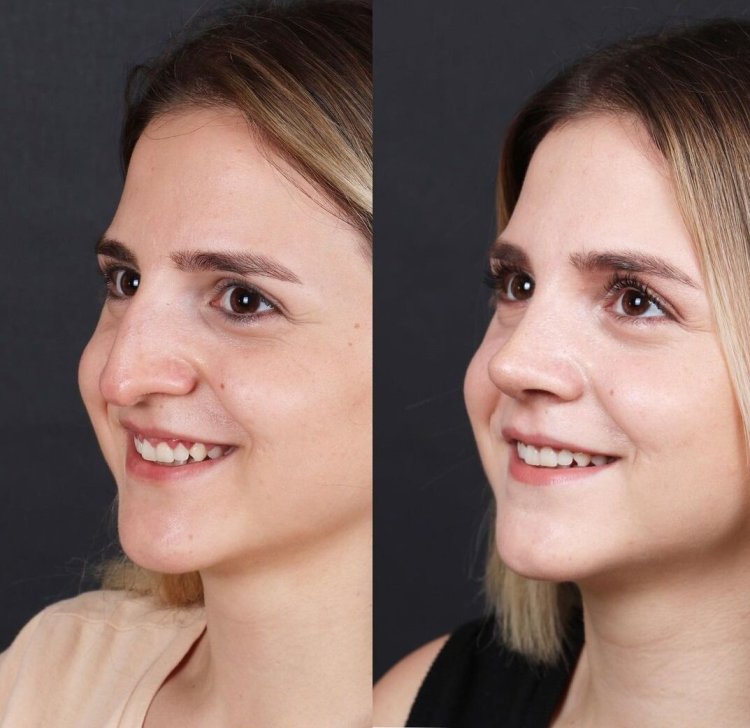 Красивые девушки с горбинкой на носу