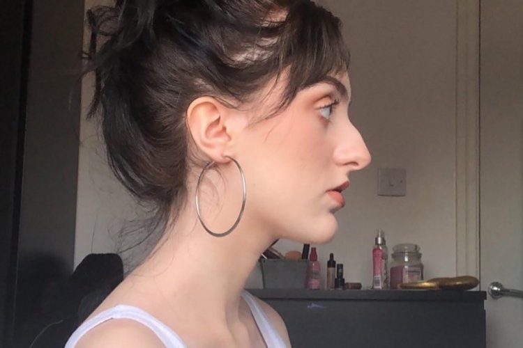 Убирание горбинки носа