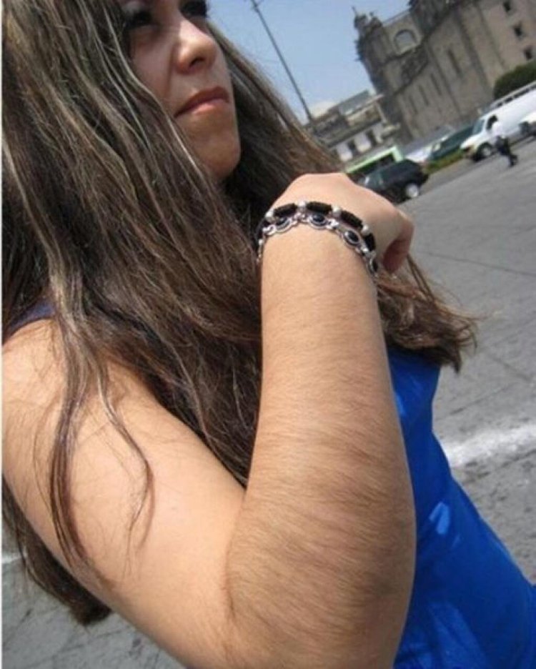 Черные волосы на руках у девушек