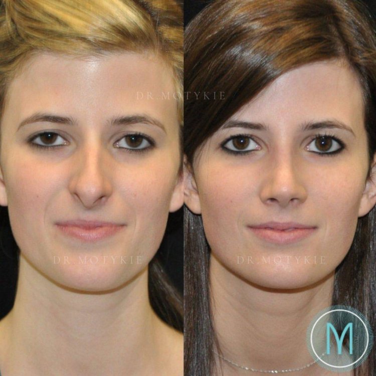 Макияж для пухлых щек