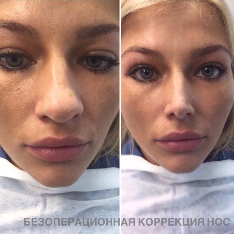 Без макияжа и фотошопа