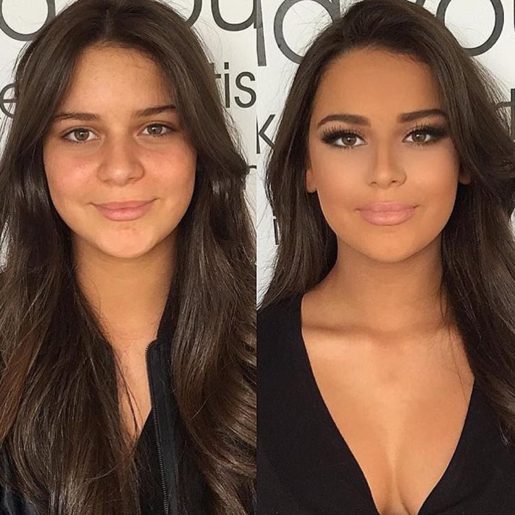 Уменьшение кончика носа