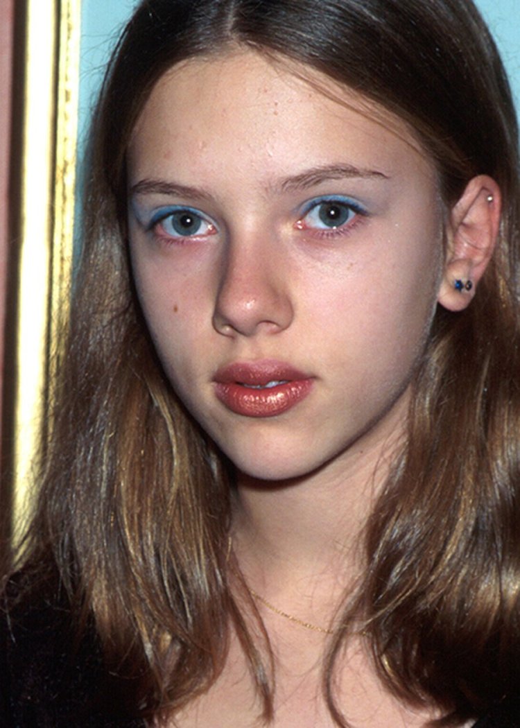 Кейт Миддлтон ринопластика