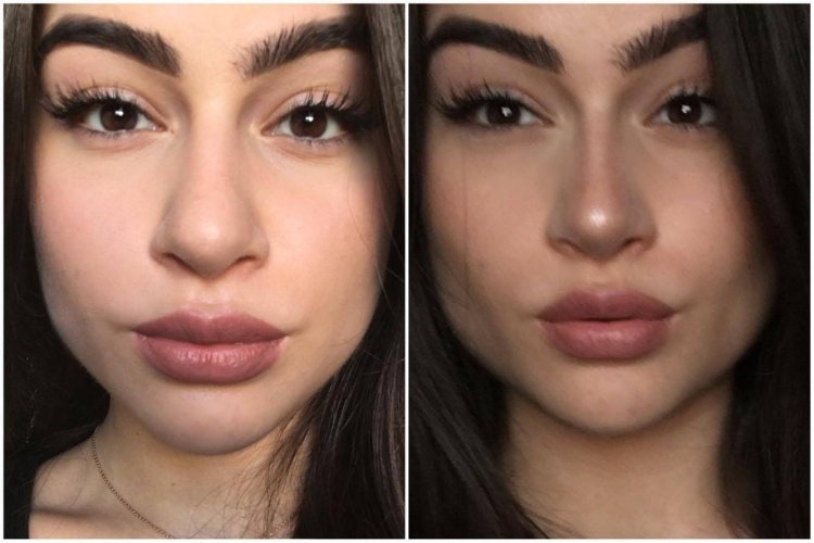 Скарлетт Йоханссон нос