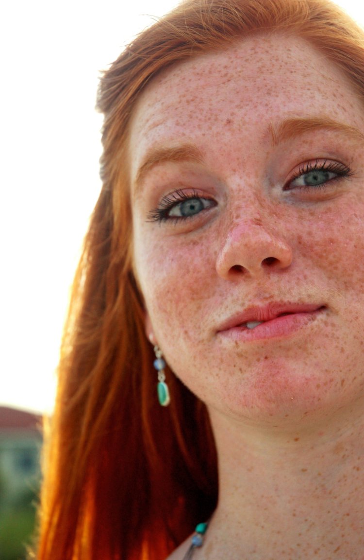 Девушка вся в веснушках