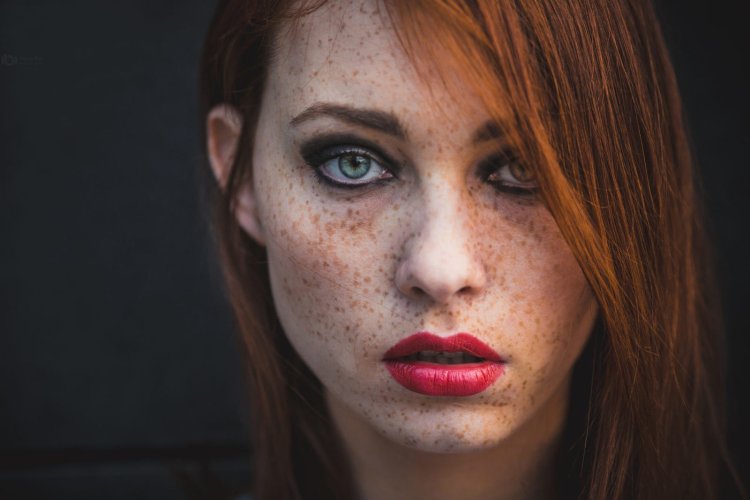 Красивые веснушки на лице