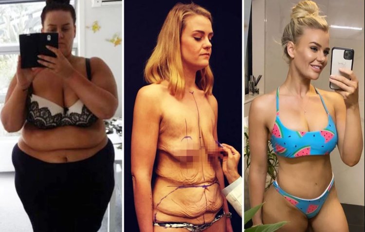 Толстые девушки до и после похудения