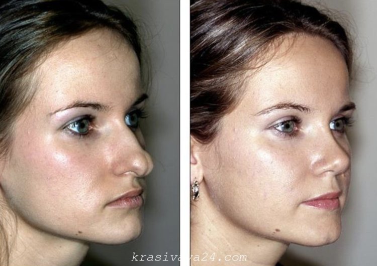 Телка с большим носом