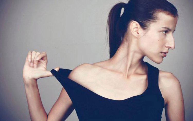 Белла Хадид до пластики