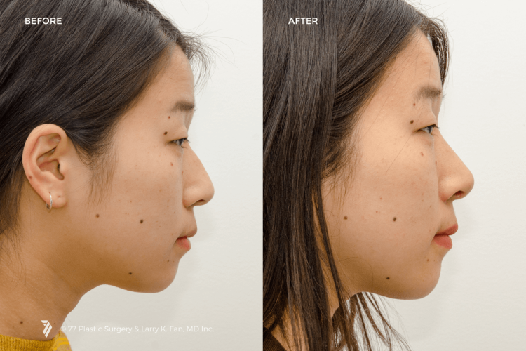 Арабский нос в профиль