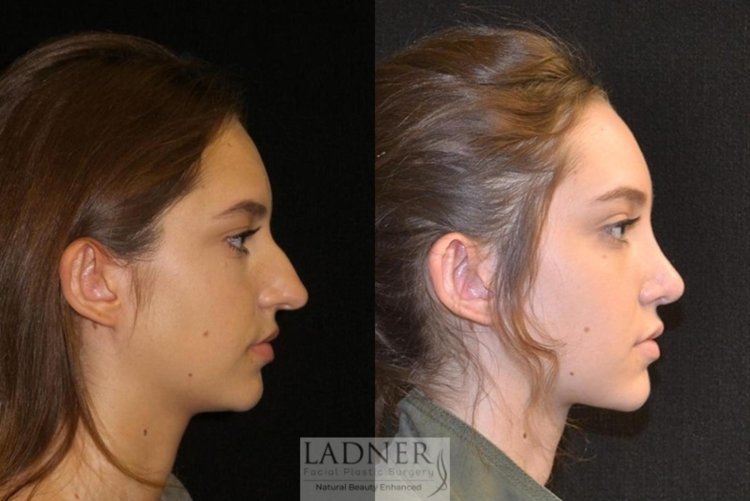 Курносый нос с горбинкой