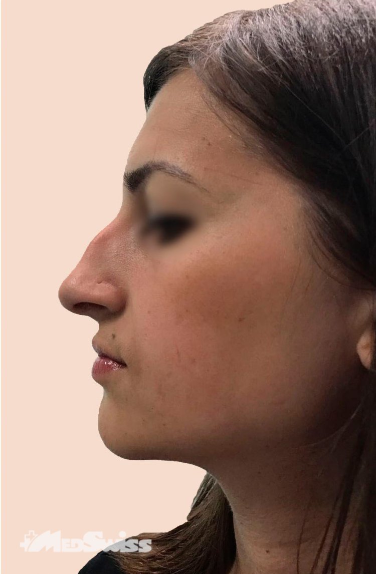 Скарлетт Йоханссон анфас и профиль