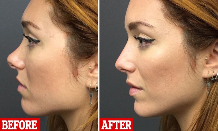 Анджелина Джоли с горбинкой