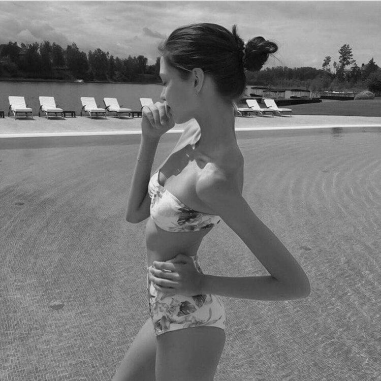 Алеся Кафельникова анорексия