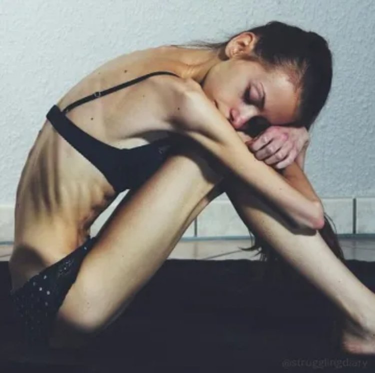 Анорексички в Нижнем белье