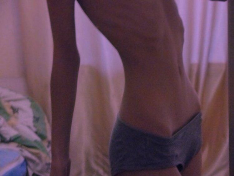 Выпирающие тазовые кости