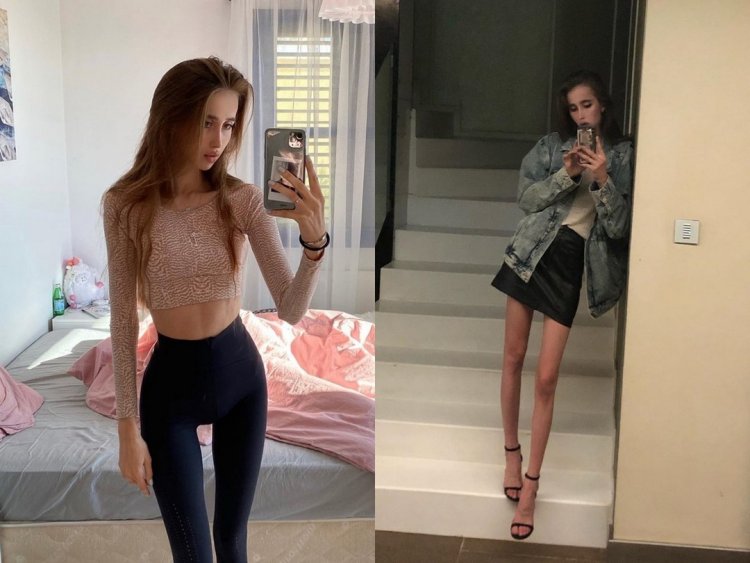 Катя Андреева Анорексичка