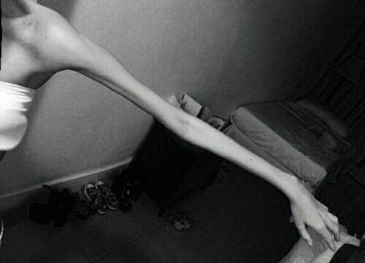 Красивое тело Анорексички