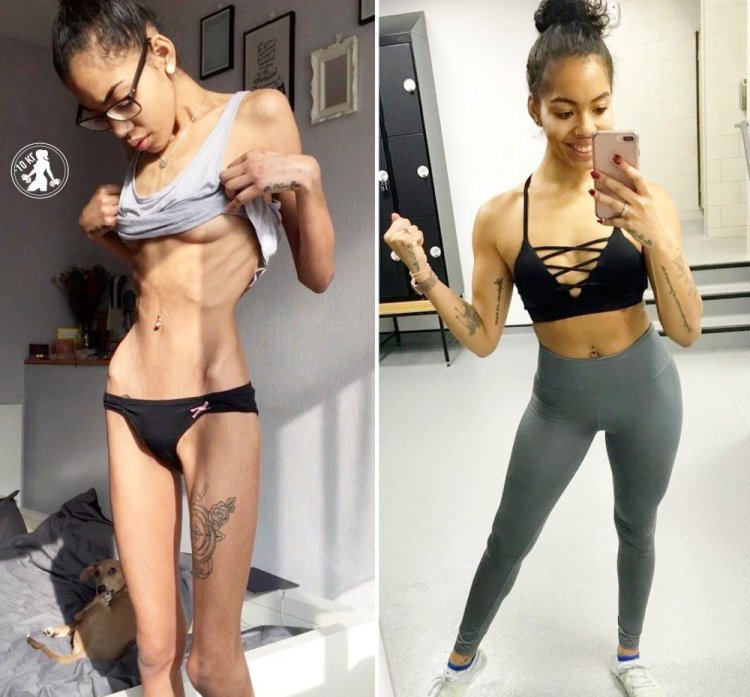 Девушки после анорексии