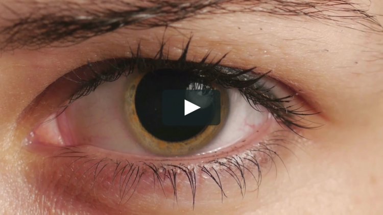 Глаза с расширенными зрачками