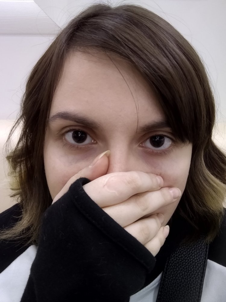 Расширенные зрачки наркомана