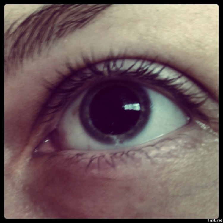 Парень с расширенными зрачками