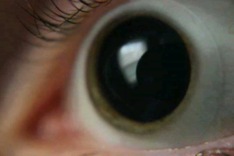 Зрачок человека расширяется