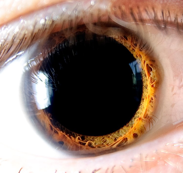 Глаз человека