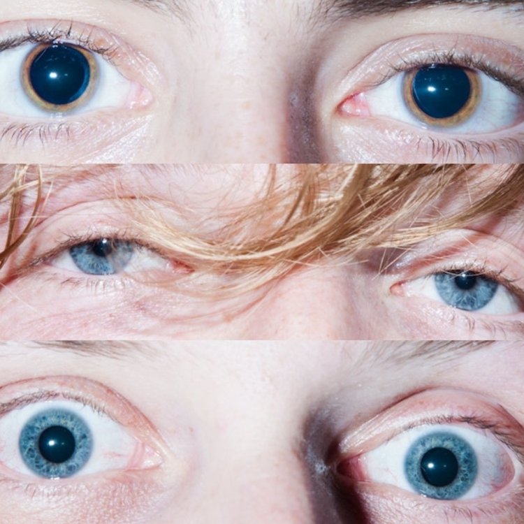 Красные зрачки у человека