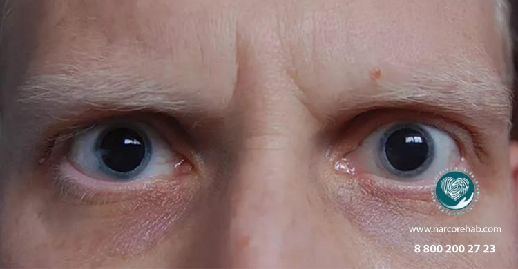 Большие зрачки у ребенка