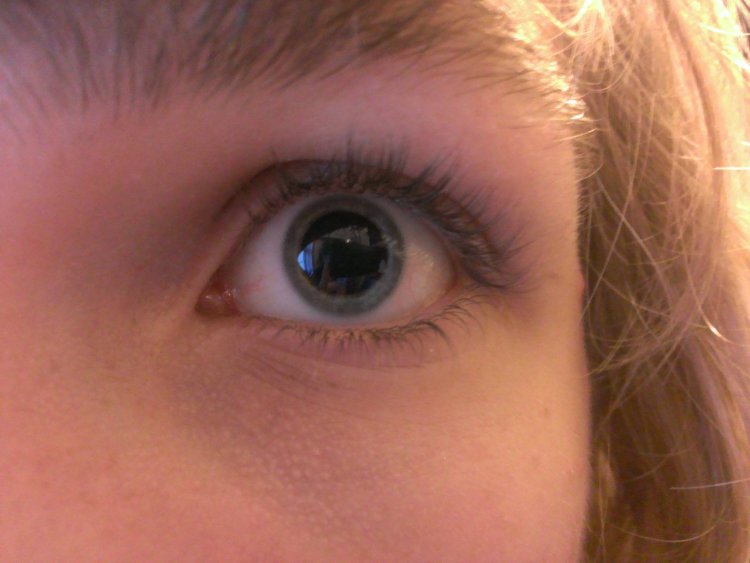 Синяя радужка глаза