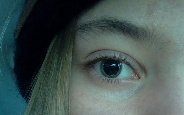 Глаза с большими зрачками