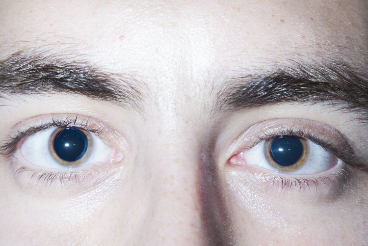 Большие женские зрачки