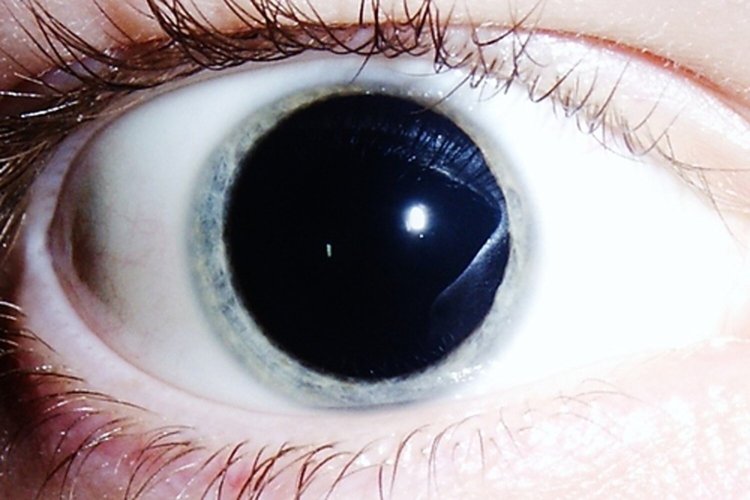Зрачок человека расширяется