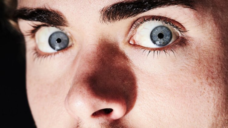 Паралитический мидриаз