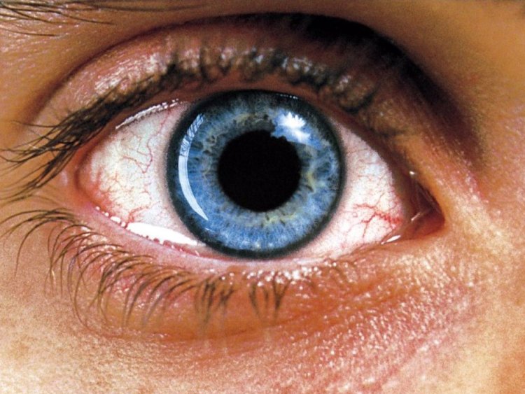 Реквием по мечте фильм 2000