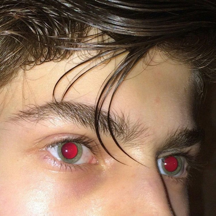 Глаза с расширенными зрачками