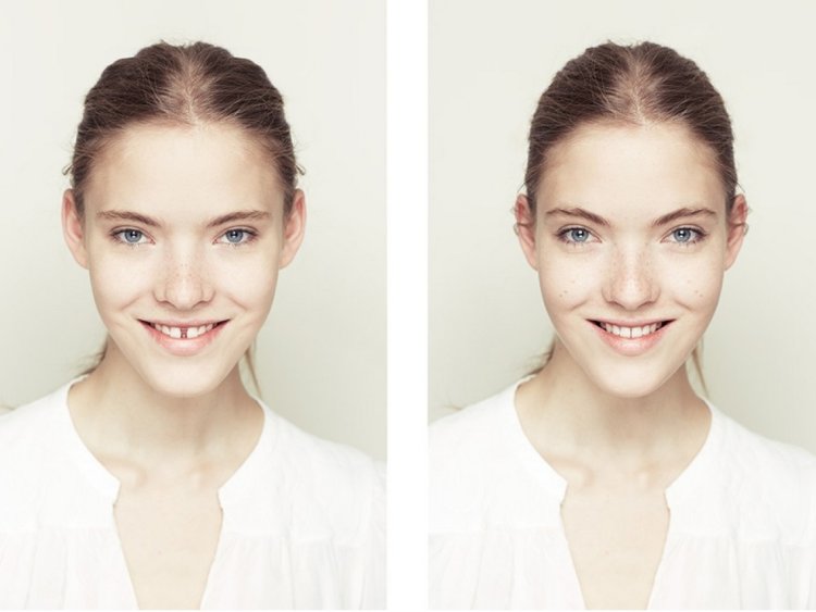 Симметрия лица