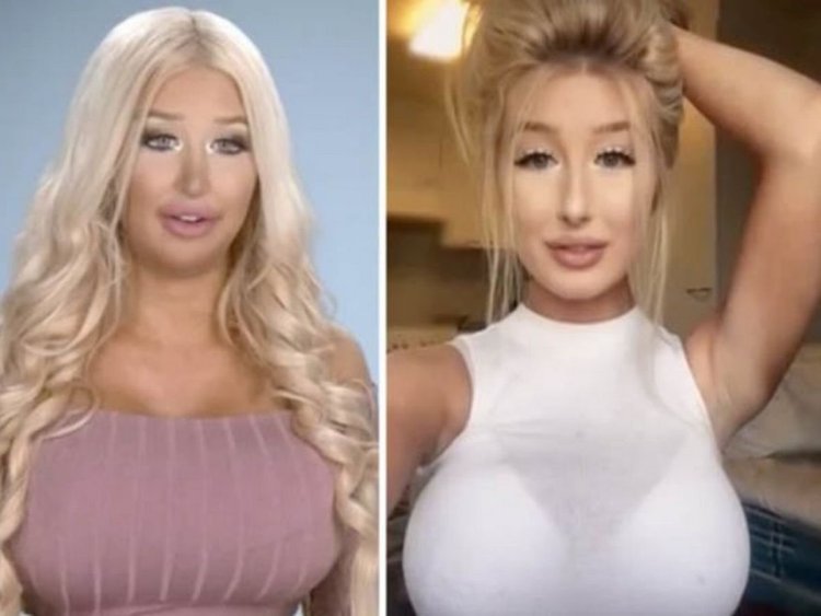 Amanda Ahola до пластики