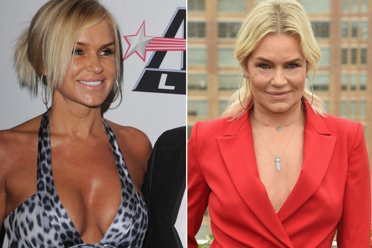 Иоланда Хадид импланты