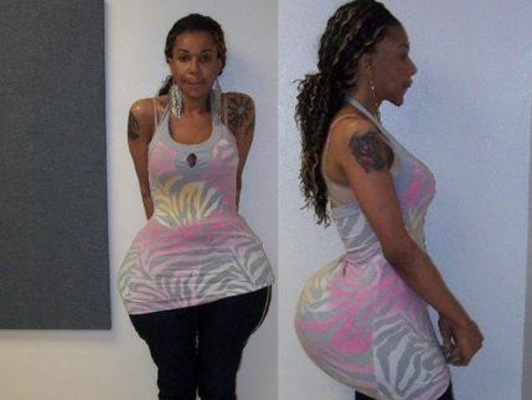 Силиконовый имплант ягодицы