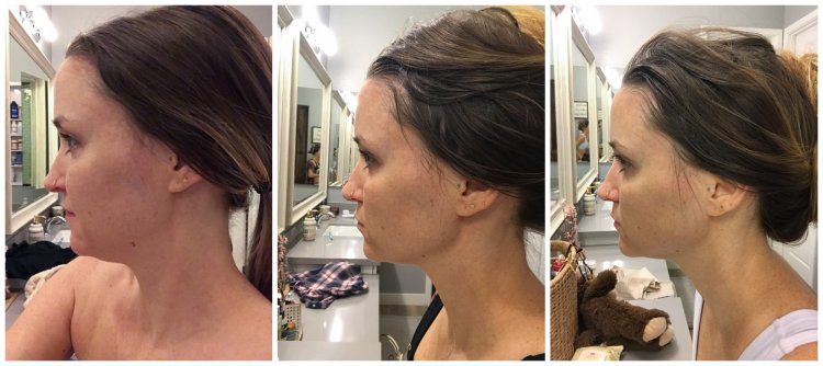 Уитни Каммингс пластические операции