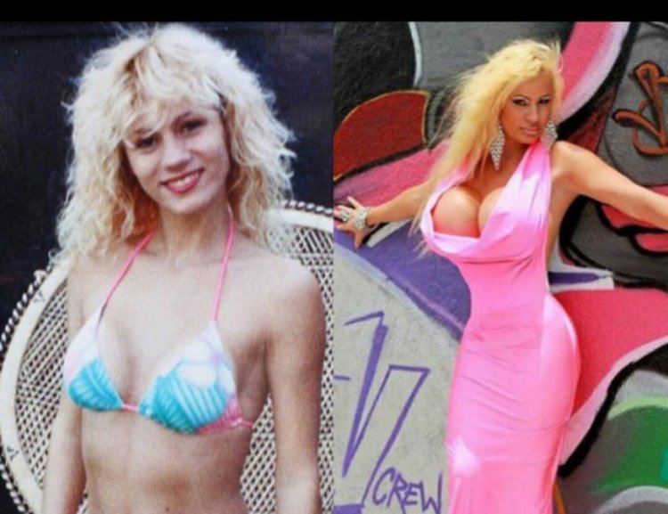 Лейси Уайлд до операций