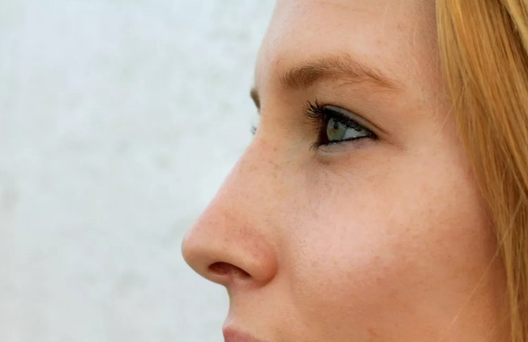 Большой нос у девушки