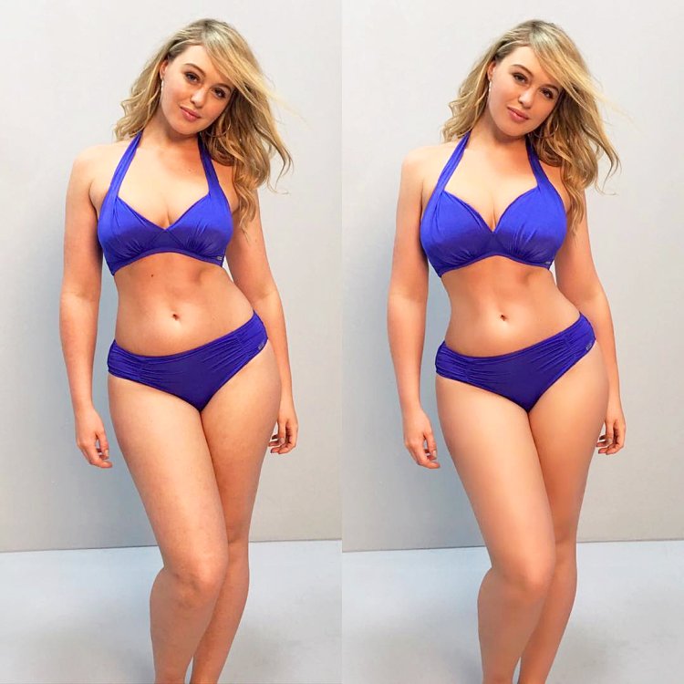 Астеник, нормостеник или гиперстеник