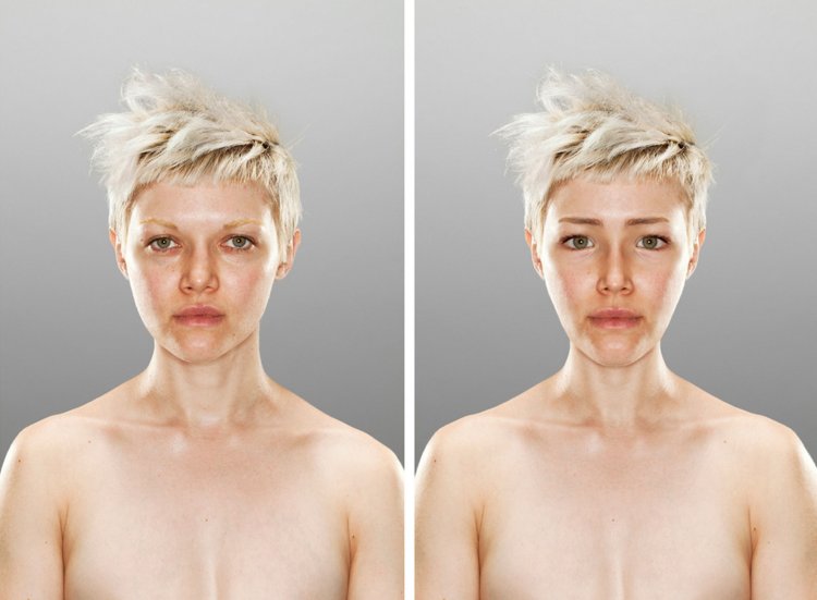 Маскулинизация у женщин